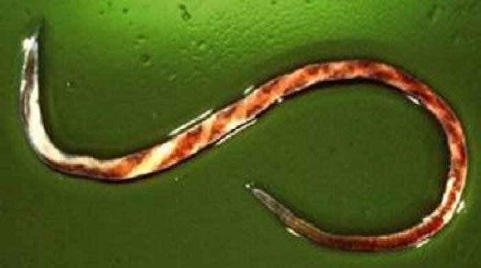 Haemonchus contortus - the barber's pole worm.